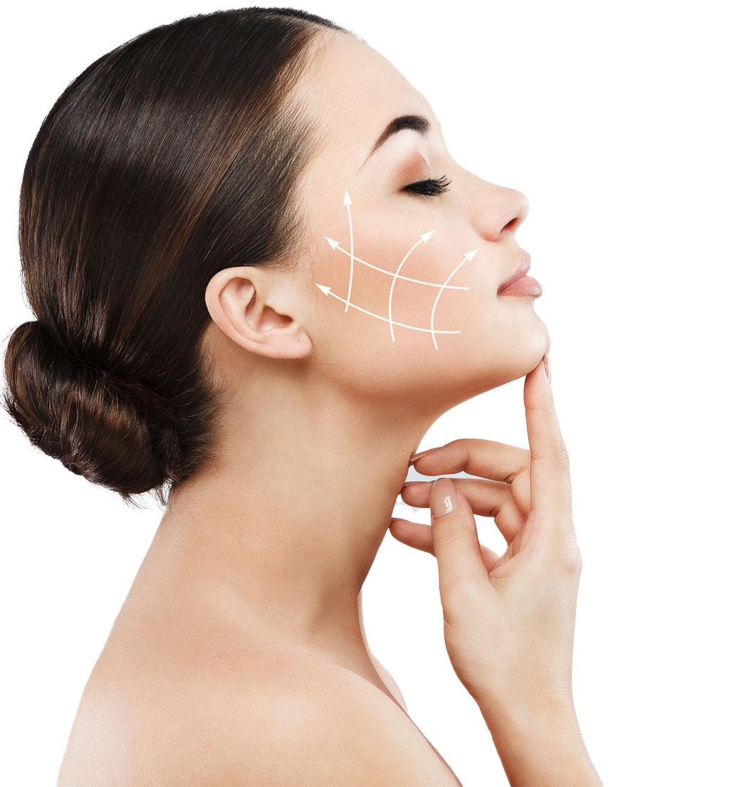 Gesicht einer Frau mit Markierungen für eine Straffung